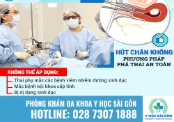 Nên Hút Thai Hay Uống Thuốc Phá Thai?