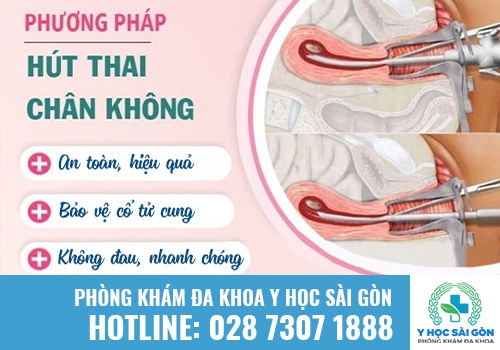 Hút thai chân không