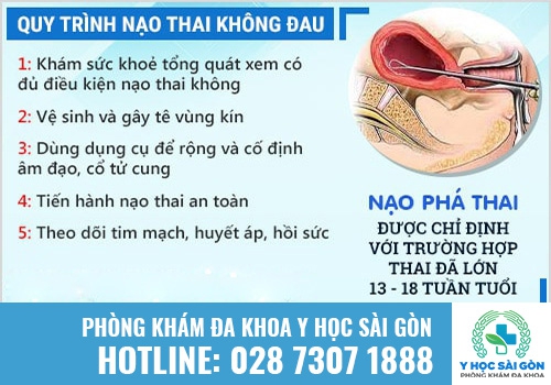 Thai bao nhiêu tuần được phép sử dụng phương pháp nạo thai?