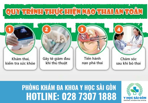 Quy trình nạo thai an toàn, hiệu quả